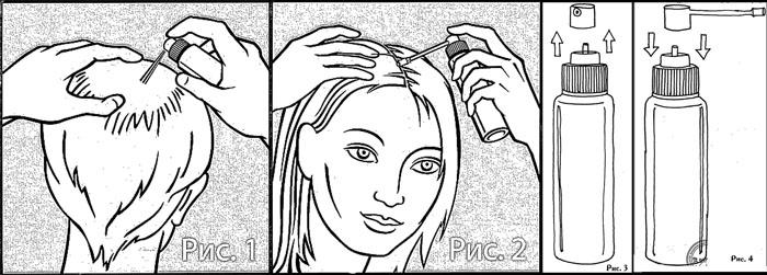 Алерана спрей для волос: инструкция по применению, состав 2- и 5-процентного, как пользоваться мужчинам и женщинам, противопоказания